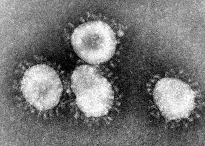 Coronavirus comment tout savoir sur le virus Coronaviruses 004 lores.jpg