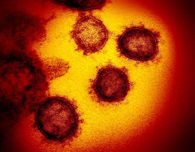 Coronavirus comment tout savoir sur le virus novel-coronavirus-sars-cov-2 49530315718 o.jpg